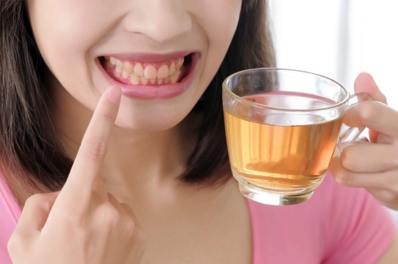 gigi kuning karena kopi